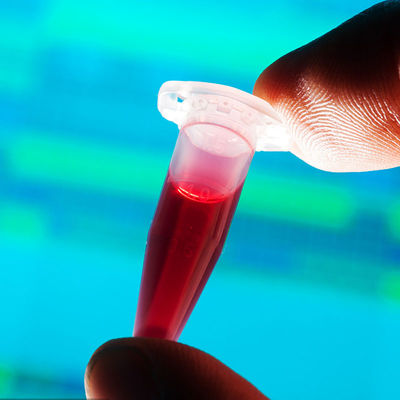 ห้องปฏิบัติการทดสอบที่ได้รับการอนุมัติจากองค์การอาหารและยา การตรวจจับอย่างรวดเร็ว ขวดนมที่สัมผัสกับอาหาร บริการตรวจสอบสิทธิ์โดยบุคคลที่สาม